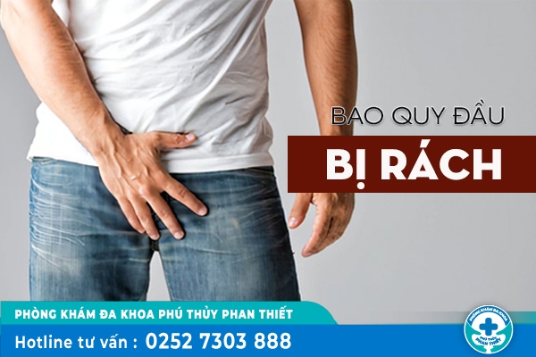 Nguyên nhân gây rách bao quy đầu và hướng dẫn cách xử lý