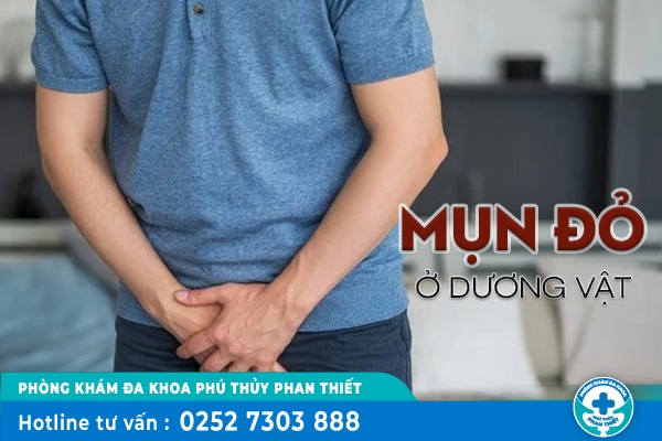 Mụn đỏ ở dương vật là bệnh gì?