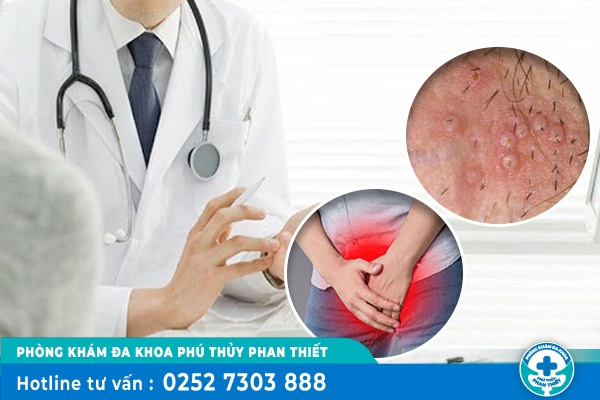 Mụn tinh hoàn là do đâu? Điều trị ra sao?