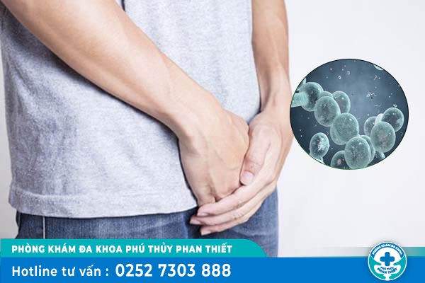 Nấm dương vật có nguy hiểm không? điều trị như thế nào?