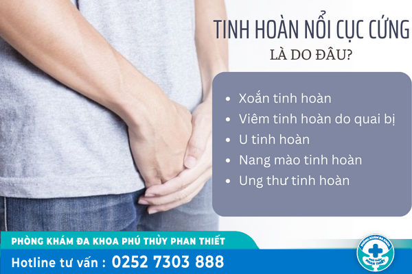 Tinh Hoàn Có Cục Cứng Là Bệnh Gì?